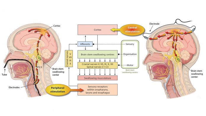 Fig. 1 Peripheral (Pharyngeal Electrical Stimulation, PES) and central (transcranial direct current stimulation, tDCS) stimulation strategies targeting the swallowing network. ©Heike Blum, Department of Neurology, University Hospital Münster, Germany. View larger image