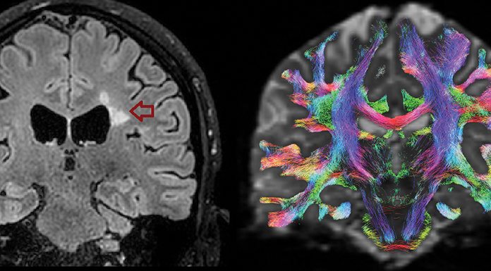 © University of Genoa