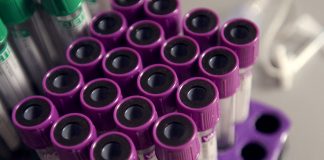 Blood test could reveal return of skin cancer