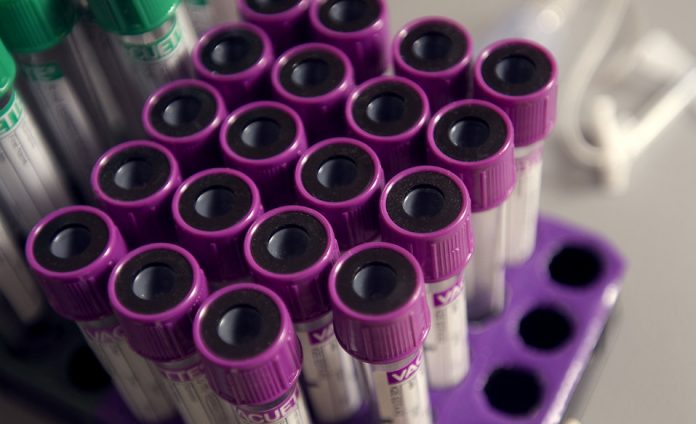 Blood test could reveal return of skin cancer