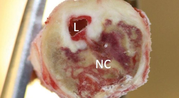 Lund University Diabetes Centre