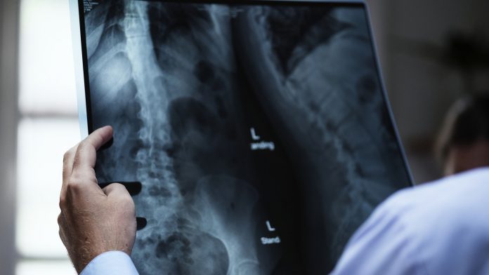 Number of lymph nodes to determine head and neck cancer prognosis Number of lymph nodes to determine head and neck cancer prognosis