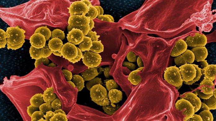 Antibiotic resistance at higher levels worldwide