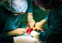Do surgery and anaesthesia cause memory issues?
