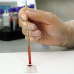 Nightingale to analyse 40,000 blood samples to enhance Finnish healthcare