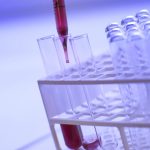 IMI launches €82m call for proposals on immune-mediated diseases