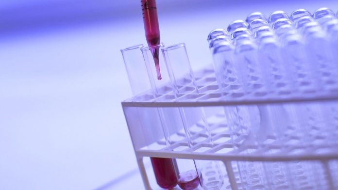 IMI launches €82m call for proposals on immune-mediated diseases IMI launches €82m call for proposals on immune-mediated diseases