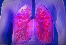 Respiratory infections increase risk of heart attack and stroke