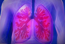 Respiratory infections increase risk of heart attack and stroke Respiratory infections increase risk of heart attack and stroke