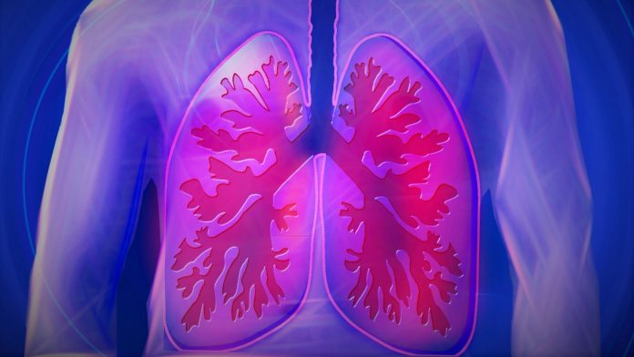 Respiratory infections increase risk of heart attack and stroke