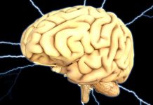 Is cholesterol a risk factor for the onset of Alzheimer’s Disease? Is cholesterol a risk factor for the onset of Alzheimer's disease?