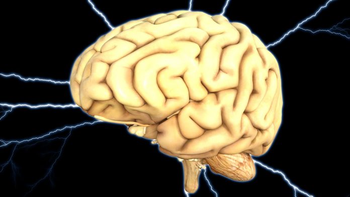 Is cholesterol a risk factor for the onset of Alzheimer's disease? Is cholesterol a risk factor for the onset of Alzheimer's disease?