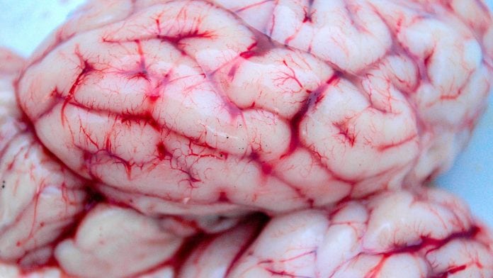How depression can negatively affect cognitive function How depression can negatively affect cognitive function