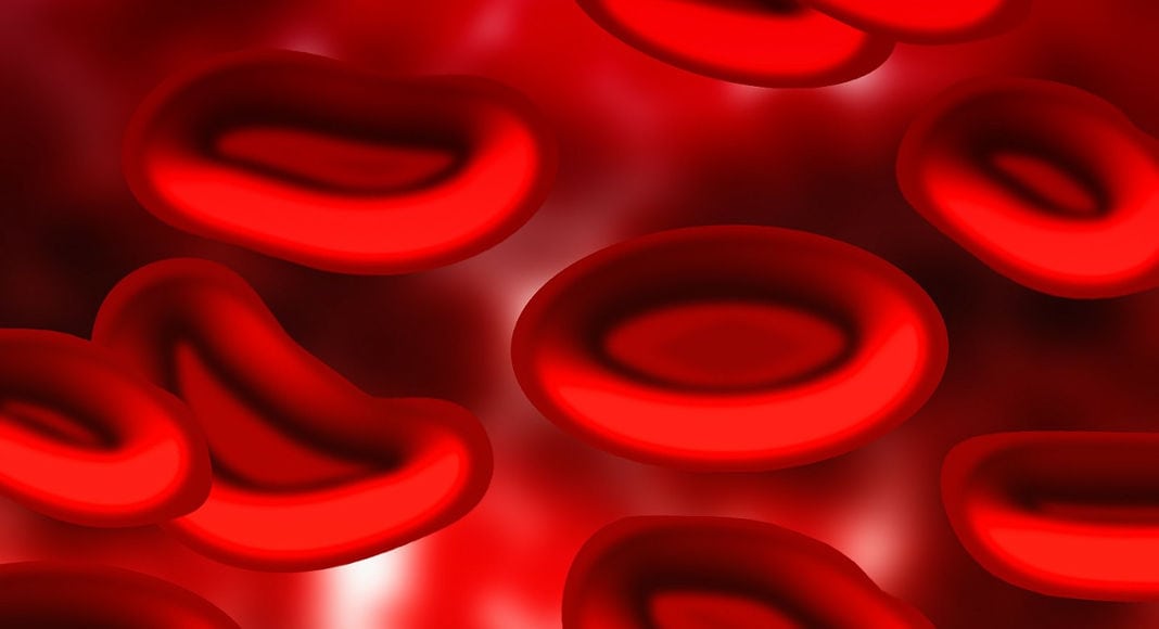 New Hepatitis C model developed that could improve treatment