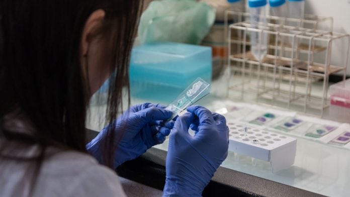 A new approach to the treatment of prostate cancer A new approach to the treatment of prostate cancer
