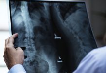 Spinal surgery found as effective as injections for osteoporosis pain relief Spinal surgery found as effective as injections for osteoporosis pain relief