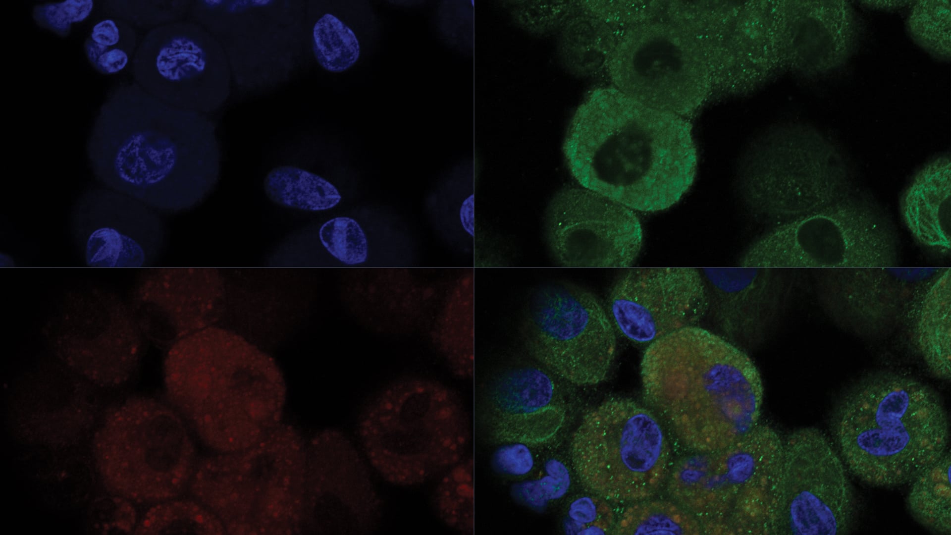 Mapping immune signalling