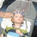 STOP-CP: Stem cell Treatment Of Perinatal Cerebral Palsy using cord blood