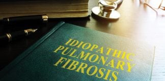The challenges of idiopathic pulmonary fibrosis