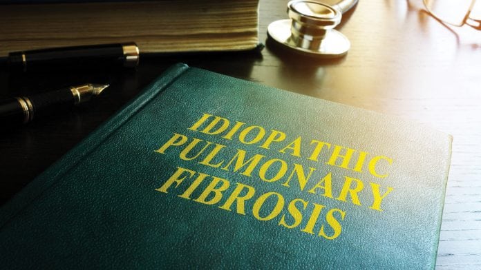 The challenges of idiopathic pulmonary fibrosis