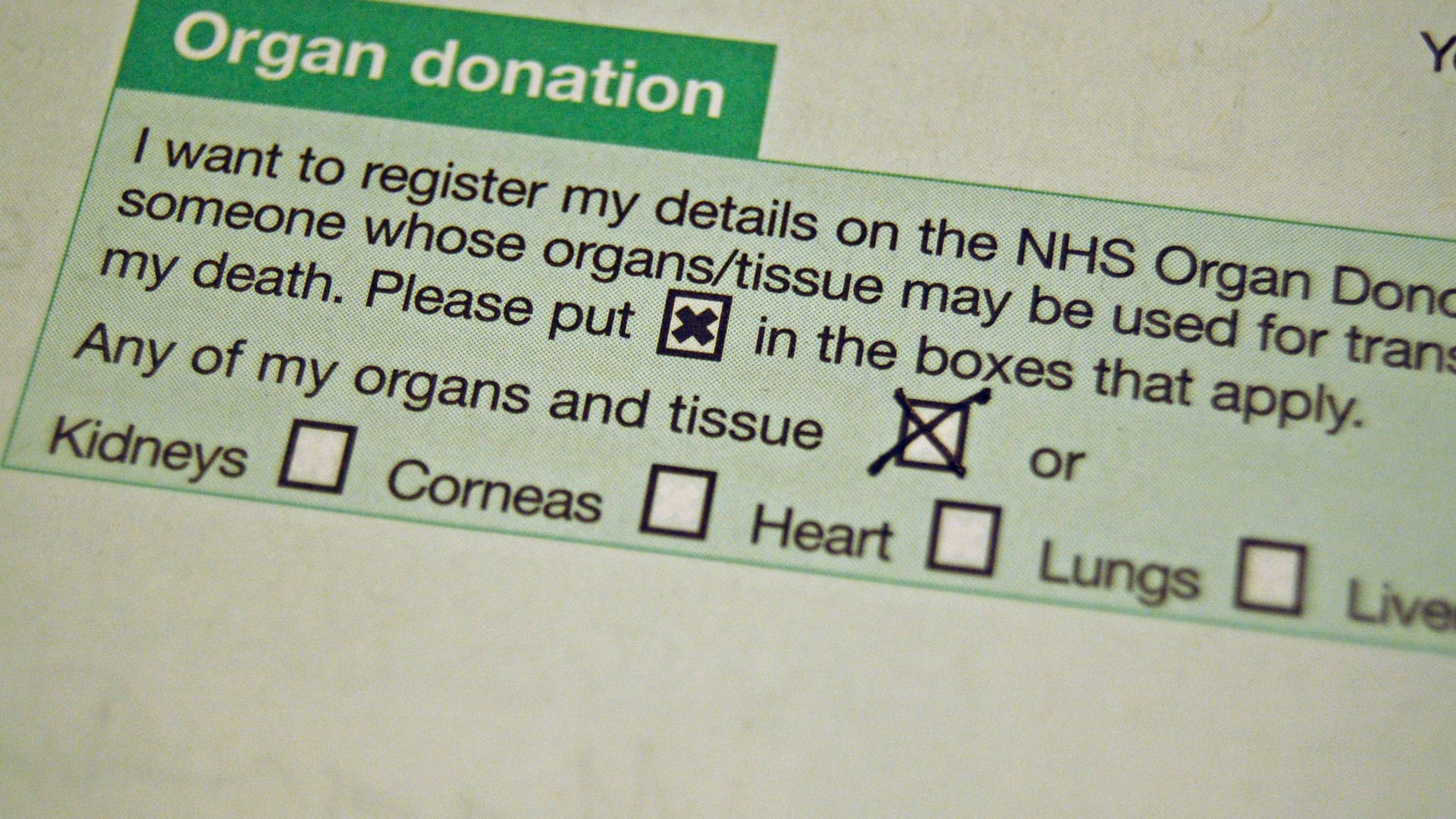 Will the opt-out organ donation register increase numbers?