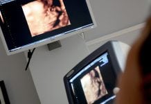 The power of ultrasound: detecting vascular disease symptoms