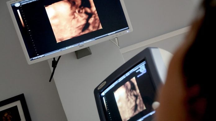 The power of ultrasound: detecting vascular disease symptoms
