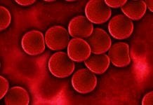 A way of detecting pancreatic cancer at its earliest stages has been found Detecting pancreatic cancer at the earliest stages