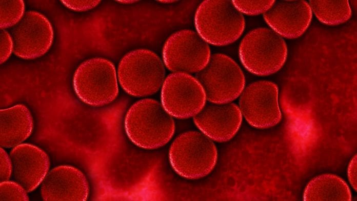 Detecting pancreatic cancer at the earliest stages Detecting pancreatic cancer at the earliest stages