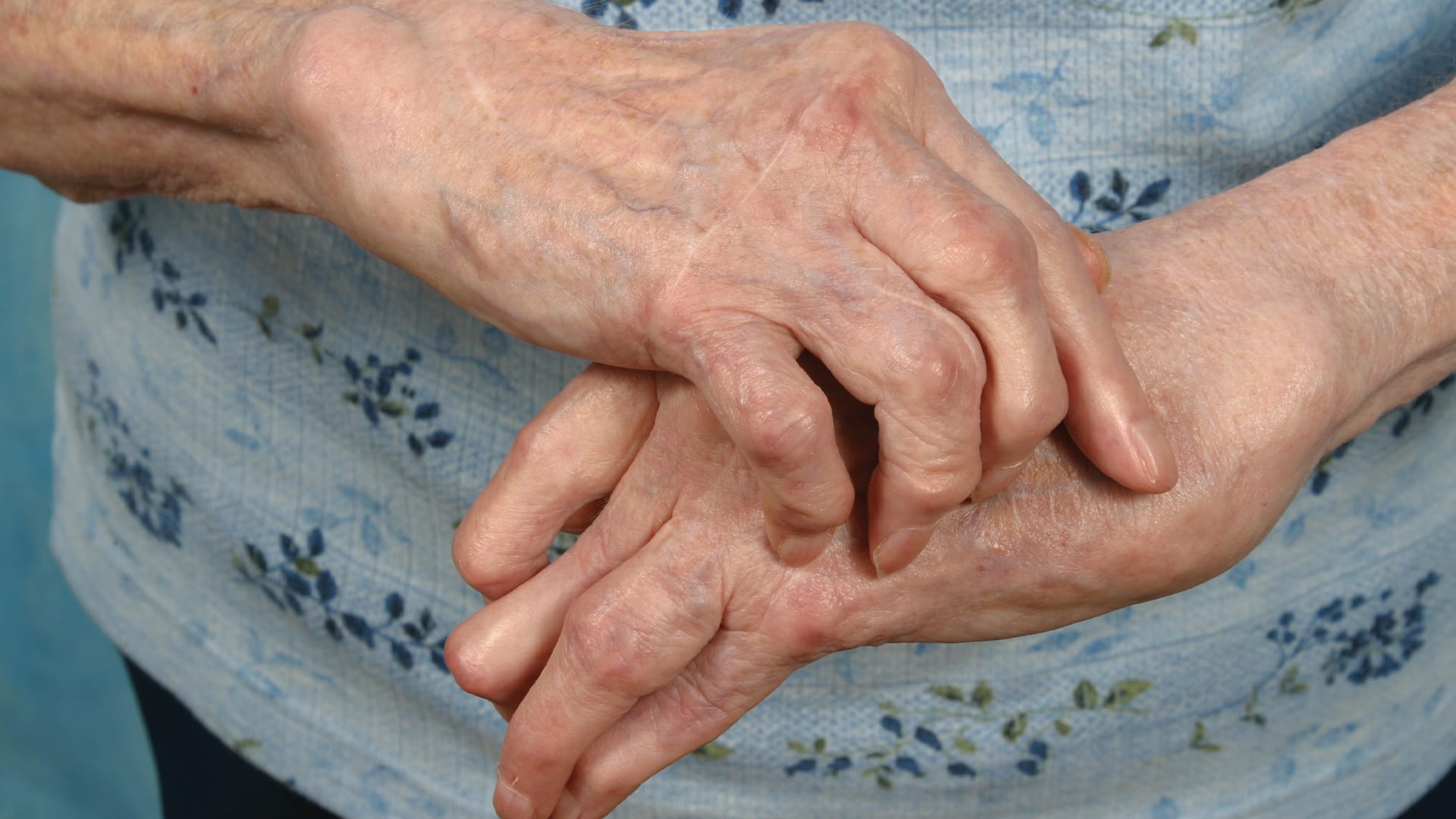 New targeted methotrexate underway for rheumatoid arthritis