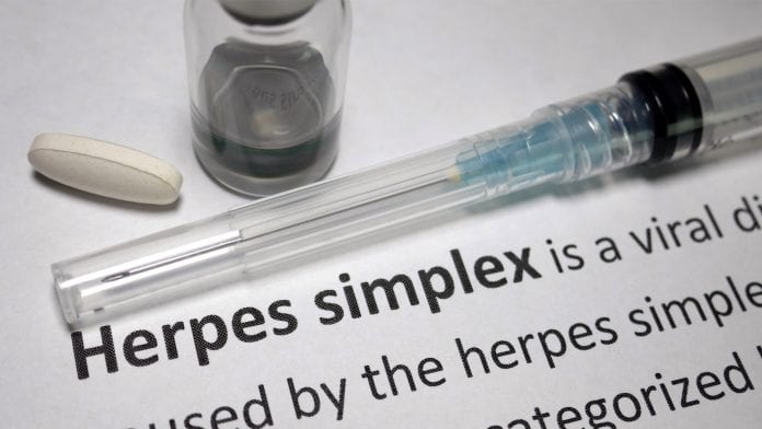 Can herpes viruses cause Alzheimer's?