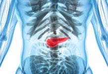 Could inflammation be the key to pancreatic cancer prevention? Could inflammation be the key to pancreatic cancer prevention?