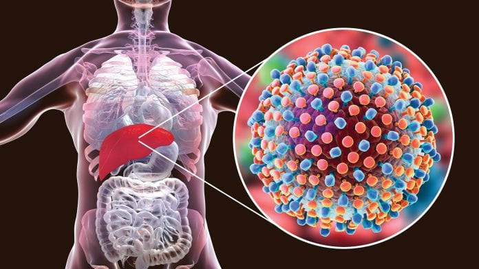 Hepatitis C in the UK – the path to elimination