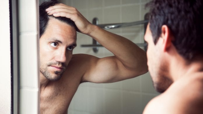 Hypotrichosis simplex: Researchers uncover new hair loss genes