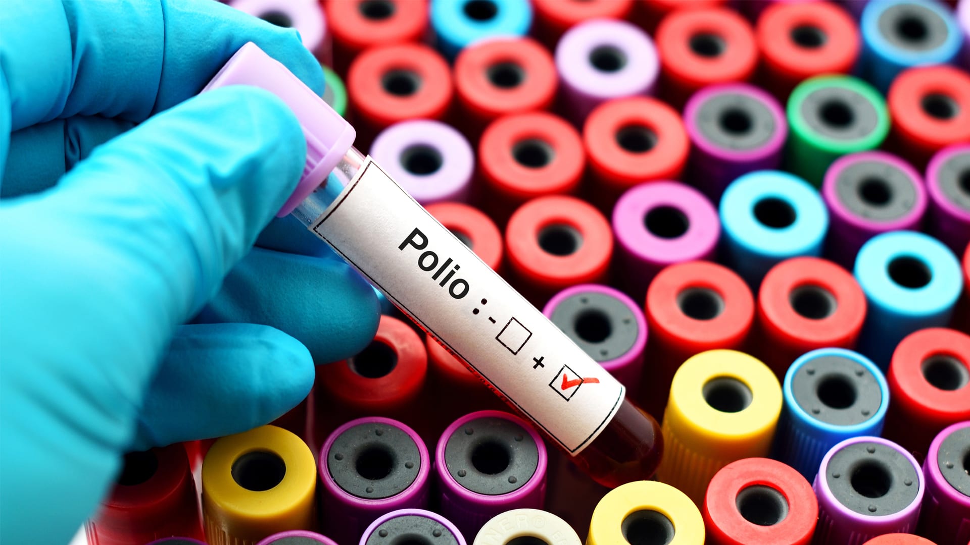What does a freeze-dried polio vaccine mean for us?