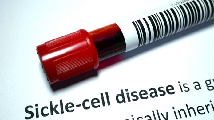 Gene therapy process reversing sickle cell anaemia symptoms