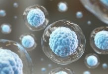 CAR T cell therapy – axicabtagene ciloleucel ready for treatment CAR T cell therapy - axicabtagene ciloleucel ready for treatment