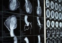 Inaccuracy in electronic prescribing is warned Inaccuracy in electronic prescribing is warned