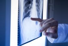 The benefits of mapping oesophageal tumours The benefits of mapping oesophageal tumours