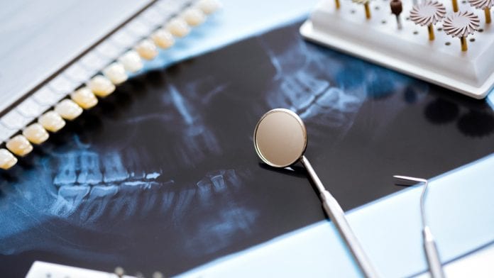 White dental implants: the world of artificial teeth