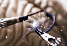 Electroshock therapy and alterations in hippocampal structural connections Electroshock therapy and alterations in hippocampal structural connections