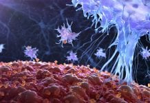 Excess body weight and the world of cancer Excess body weight and the world of cancer