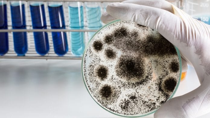 The crippling effects of Aspergillus fumigatus on the human immune system