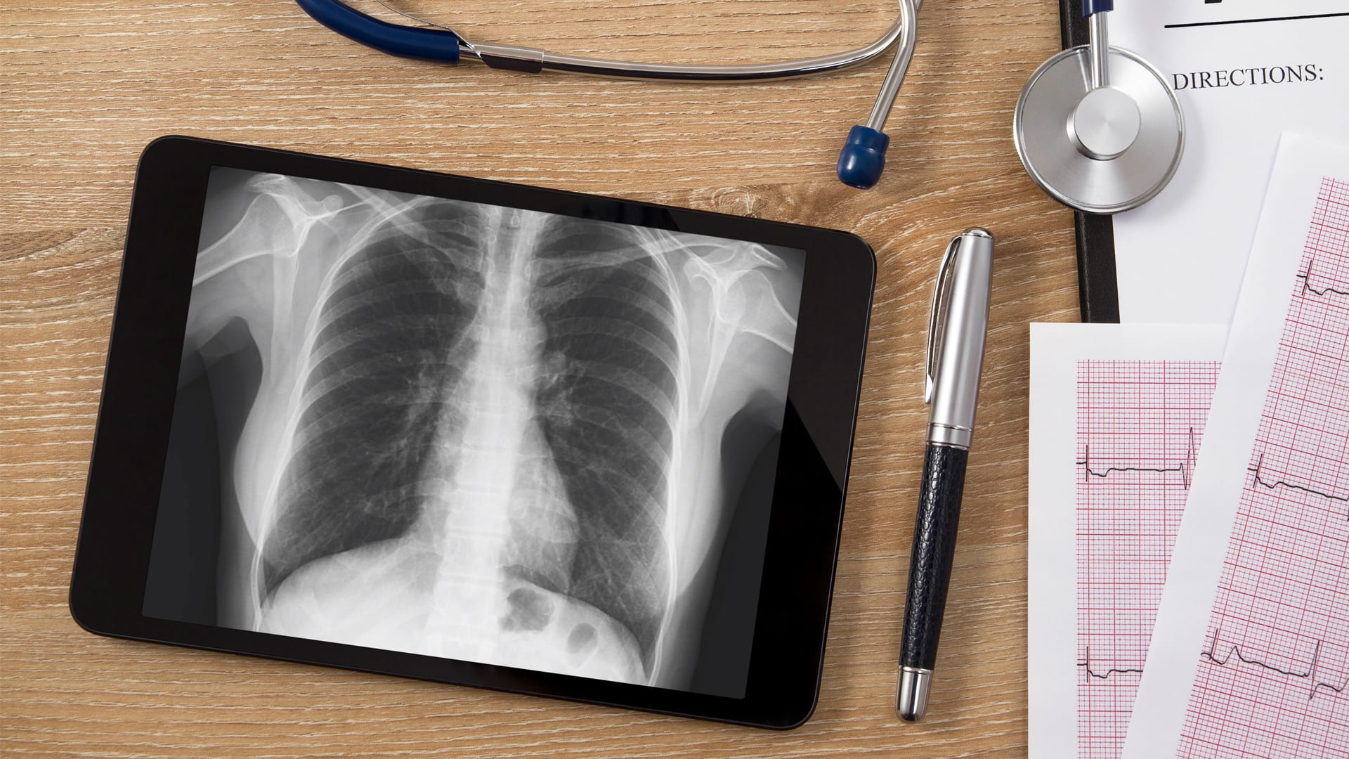 What do you know about immune checkpoint inhibitors?