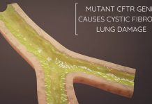 Developing a first-in-class regenerative gene therapy for cystic fibrosis