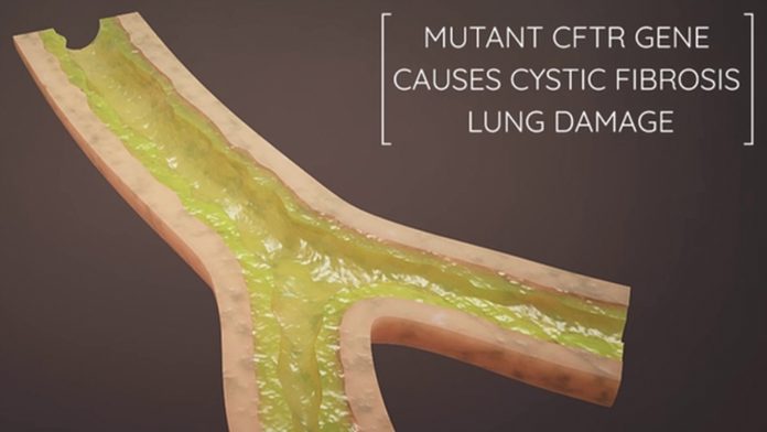 Developing a first-in-class regenerative gene therapy for cystic fibrosis