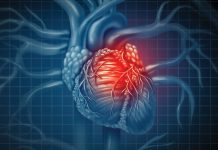 What do you know about congenital heart defects and later-life illness? What do you know about congenital heart defects and later-life illness?