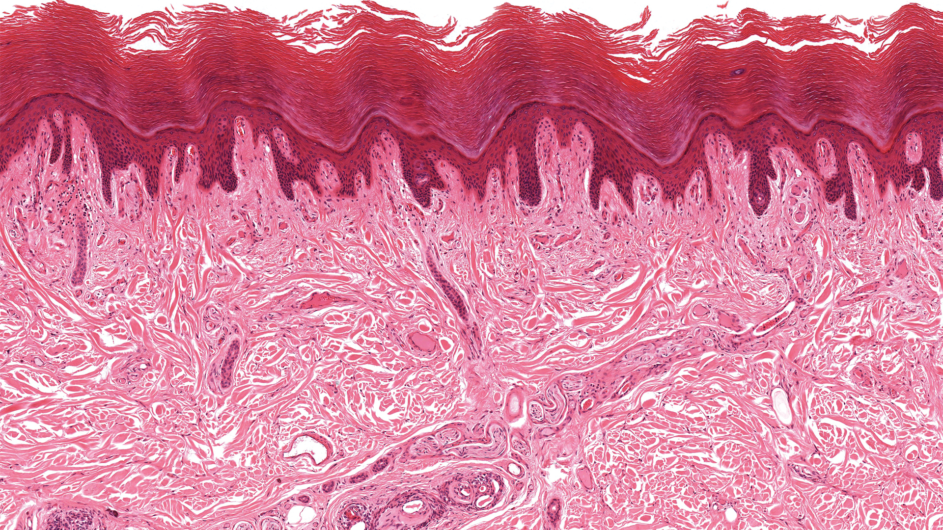 BRoTHER – Can digitalisation improve the interaction of tissue biobanks?