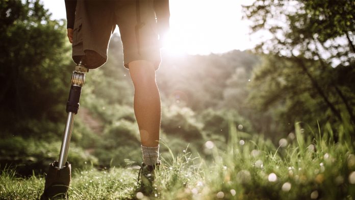 Every two hours in England, someone loses their leg due to a non-healing wound