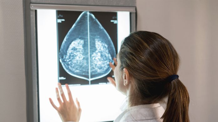 Priorities for breast cancer resources questioned after global HER2 testing survey